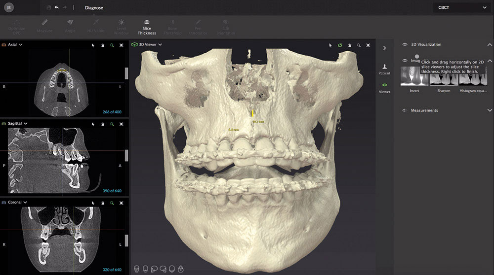顎の状態を精密に把握「CT分析」