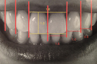 前歯の並びに存在する”黄金比”